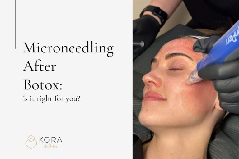 microneedling after botox scottsdale