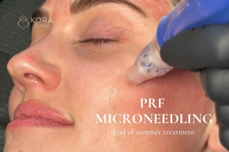 prf microneedling summer heat scottsdale az