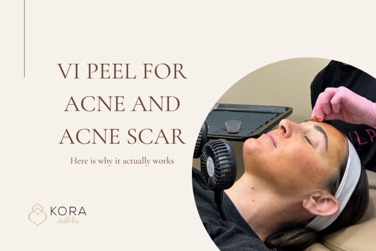 vi peel for acne and acne scar scottsdale