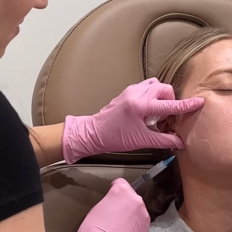 Professional Sculptra collagen biostimulator injection procedure in Scottsdale