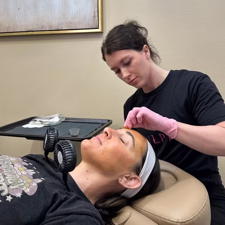 Professional VI Peel Precision Plus chemical peel treatment for melasma and pigmentation in Scottsdale